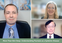 More Than Skin Deep: Understanding Psoriasis as a Systemic Disease