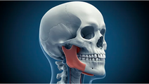 Masseter