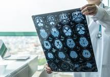 NYP Neurology