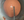 Figure 3. To inflate the Berger space and separate the anterior vitreous hyaloid from the posterior capsule, OVD is slowly injected at the level of the PCR.