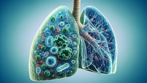 Pseudomonas Aeruginosa A Crucial Consideration in Lung Transplant Rejection
