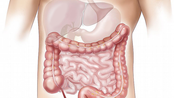 Symptoms of unhealthy colon