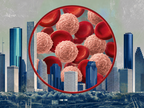 Today’s CLL/SLL Decisions, Tomorrow’s Options: Practical Strategies for the Com…
