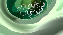 New Discovery in Crohns Disease Yersiniabactins Role in Intestinal Fibrosis