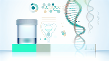 Urine Transcriptomics as a Tool for Non Invasive Genitourinary Disease Diagnosis