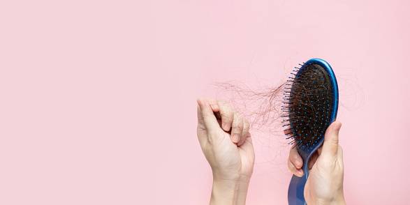 Alopecia