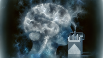 The Link Between Smoking and Unexplained Stroke in Younger Adults