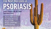 psoriasis