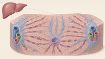 biopsy proven sld subtypes show distinct fibrosis patterns
