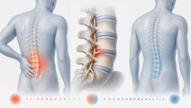 opioid use and pain resolution in opioid naive adults with acute pain