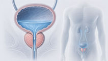 tamsulosin deprescribing in older men with lower urinary tract symptoms
