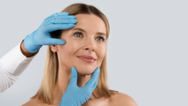facelift
