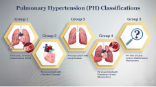 Basics of Pulmonary Hypertension