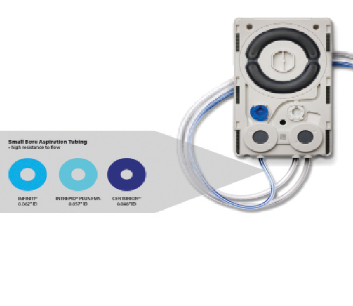 Figure 1. The fluid management cartridge for the Centurion.
Visible are the dual elastomer segments as well as the
irrigation and vacuum sensors essential to the active fluidic
feedback loop.