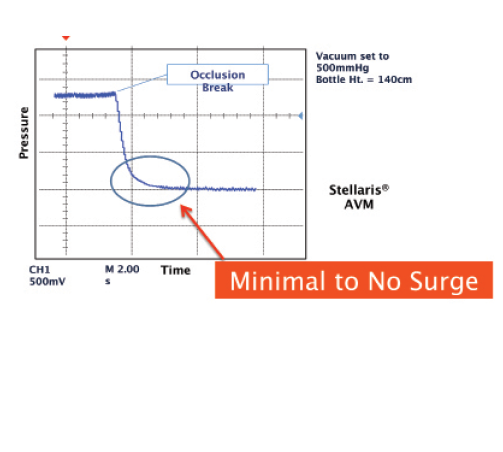 Figure 1. The Advanced Vacuum Module StableChamber
Fluidics System minimizes surge with a 1.8-mm
microincisional cataract surgery tip during high vacuum.
Data on file with Bausch + Lomb.