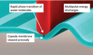 Figure 2. A cleavage plane is created in the capsular membrane with low-energy, precision-pulse technology.