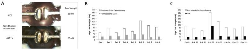 Figure 4. Tensile strength of manual capsulorhexis (top) versus Zepto capsulotomy (bottom) in a paired human cadaver eye study (A). The tensile strength was better across all paired eyes in the Zepto group than the femtosecond laser (B) and manual capsulorhexis (C) groups..