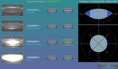 Figure 3. The surgeon programs patterns based on cataract
morphology and surgical preferences. The laser maps each
cataract and identifies density categories 1 through 4. CDI
software auto-assigns predefined fragmentation patterns.