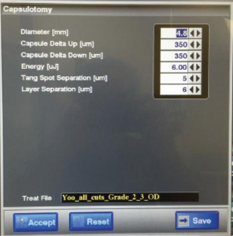 Figure 1. Capsulotomy advanced settings menu on the LenSx Laser. Energy, tangential spot separation, or layer separation values can be altered in specific situations, like hypermature cataracts, to increase the likelihood of a complete capsulotomy.