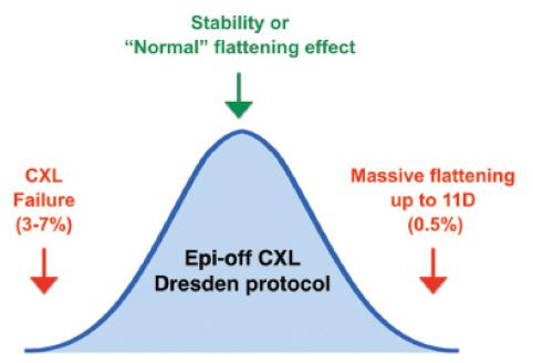 Figure 1. Gaussian distribution of outcomes after Dresden protocol epi-off CXL procedure. Whereas approximately 60% of all cases show either stability or a normal flattening effect with a mean of 2.70 D, failure to arrest ectasia or extreme flattening may be observed in 3% to 7% and 0.5% of cases, respectively.