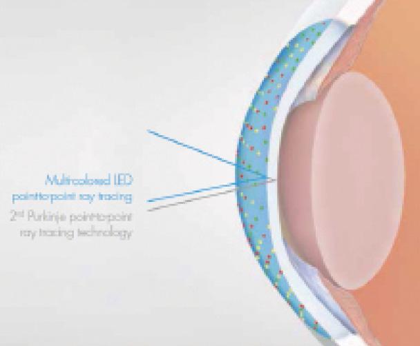Figure 2. Patented multicolored LED point-to-point ray tracing provides a GPS-like analysis of the cornea.