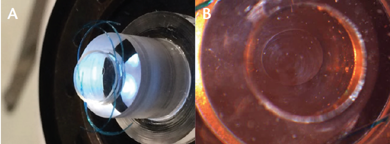Figure 1. Proof of concept: Disassembled piston/cylinder with stacked off-the-shelf silicone lens implants with a 6 mm diameter (A) and a retroilluminated microscopic image of the applanating interface (B).