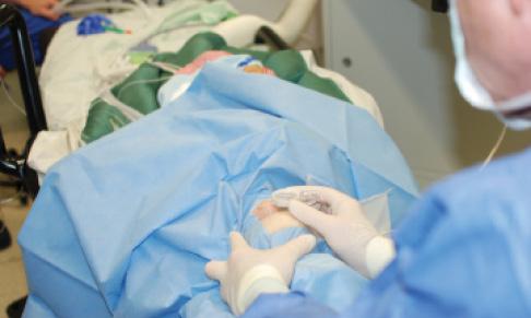 Figure 1. Sterile docking in pediatric laser cataract surgery.
