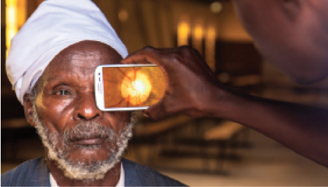 Figure 3. Retinal imaging is performed with Peek.