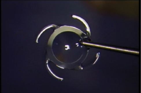 Figure 4. A four-C-loop haptic design (FA7010) prevents optic tilt.