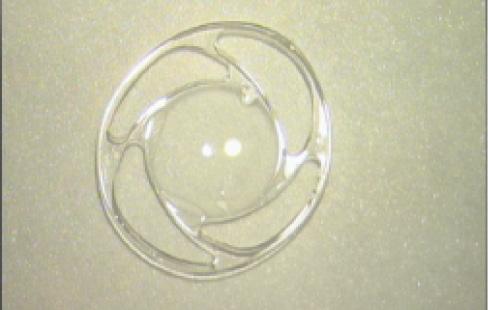 Figure 5. The Oval Ring four-C-loop IOL (42A) has the advantage of improving the consistency of the effective lens position and adapting to the size of the capsular bag.