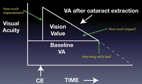 Figure 1. A graphic representation of what can happen after cataract extraction (CE) in a patient with AMD progression.