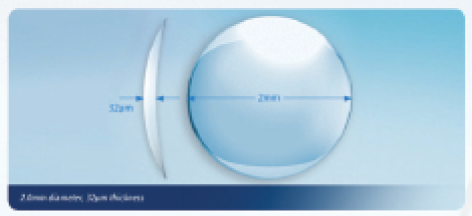 Figure 1. The Raindrop corneal inlay, 2 mm wide and
30 μm thick, creates a dedicated near vision zone in the
central cornea. Placed in the nondominant eye, it provides
functional reading vision for the patient. The inlay modifies
the central corneal curvature in the implanted eye, resulting
in a prolate shape that creates a multifocal optical system in
the cornea and allows the patient to see both far and near in
the operated eye.