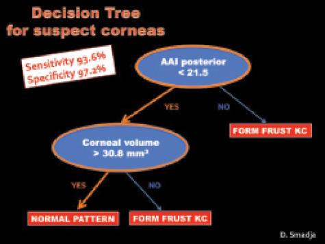 Figure 1. An AAI score of 21.5 is the most discriminant
parameter to differentiate between normal corneas and
subclinical keratoconus.