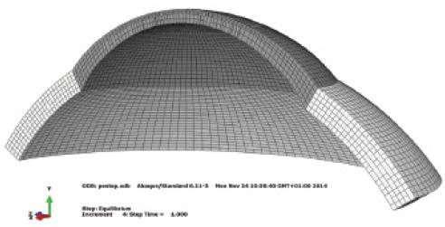 Figure 1. Finite-element model of the cornea (gray) and parts of the sclera (white). The brick-like elements are hexahedral finite elements that form the 3-D volume mesh. IOP is simulated on the inside of the model. The model was cut in half for display; simulations are carried out with full 3-D models.