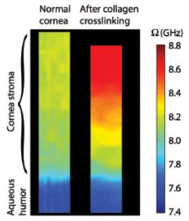 Figure 1. Brillouin images of normal
porcine corneal tissue before and
after standard epi-off CXL. Imaged
area: 800 (z) X 50 μm (x).