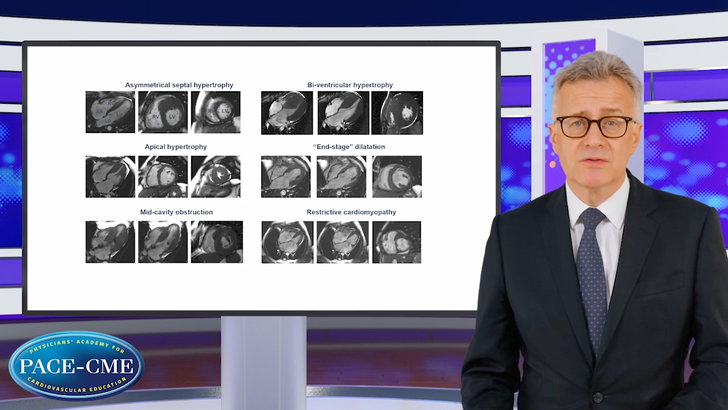 HCM: Understanding the Condition