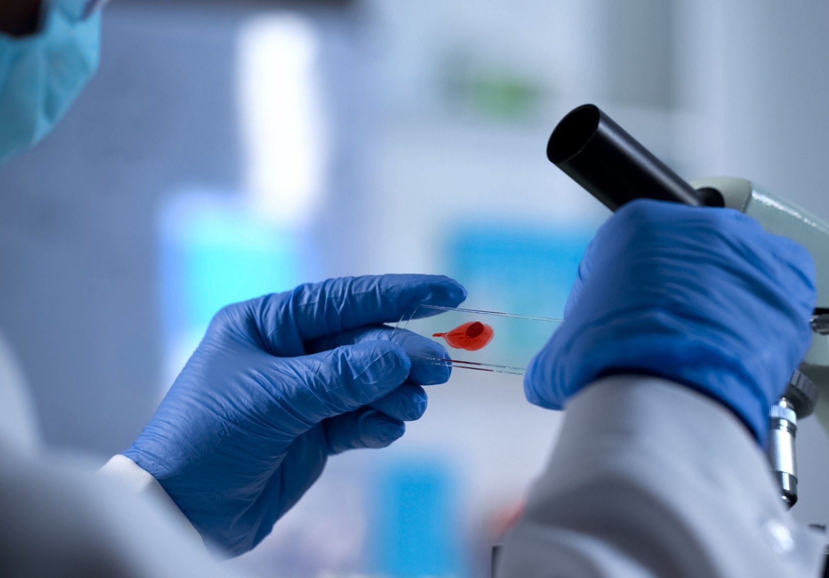 U of M Research Advances Potential HIV Cure Strategy - Be part of the ...