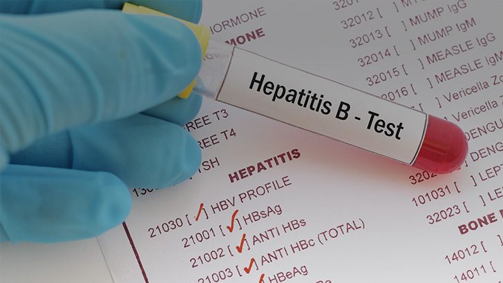 Exploring the Hepatitis B Treatment Landscape Medical Education on ReachMD