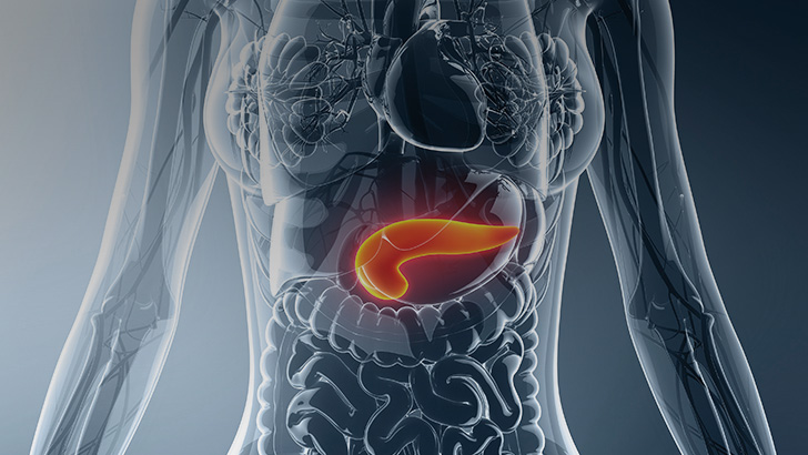 A Look at the Diagnosis & Treatment of Acute Pancreatitis