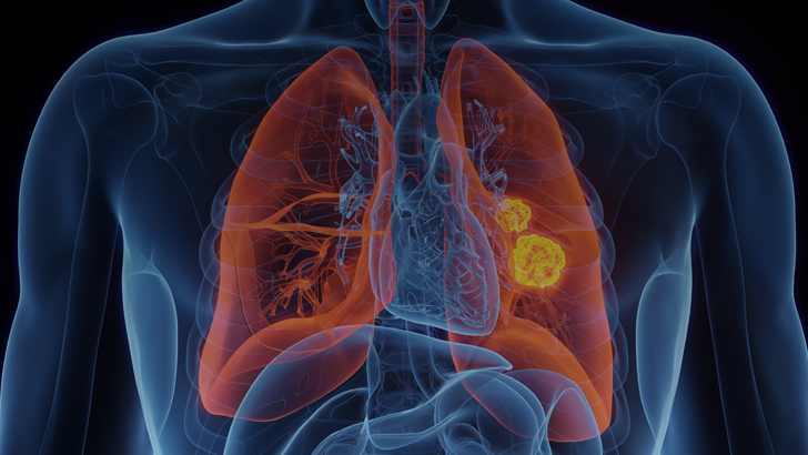 CME; Bispecific antibodies, mobocertinib, amivantamab, CHRYS