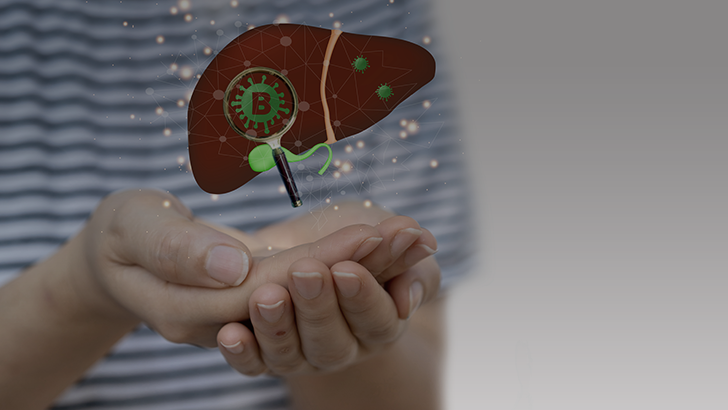 Managing Hepatocellular Carcinoma with Hepatitis B Co-Infect